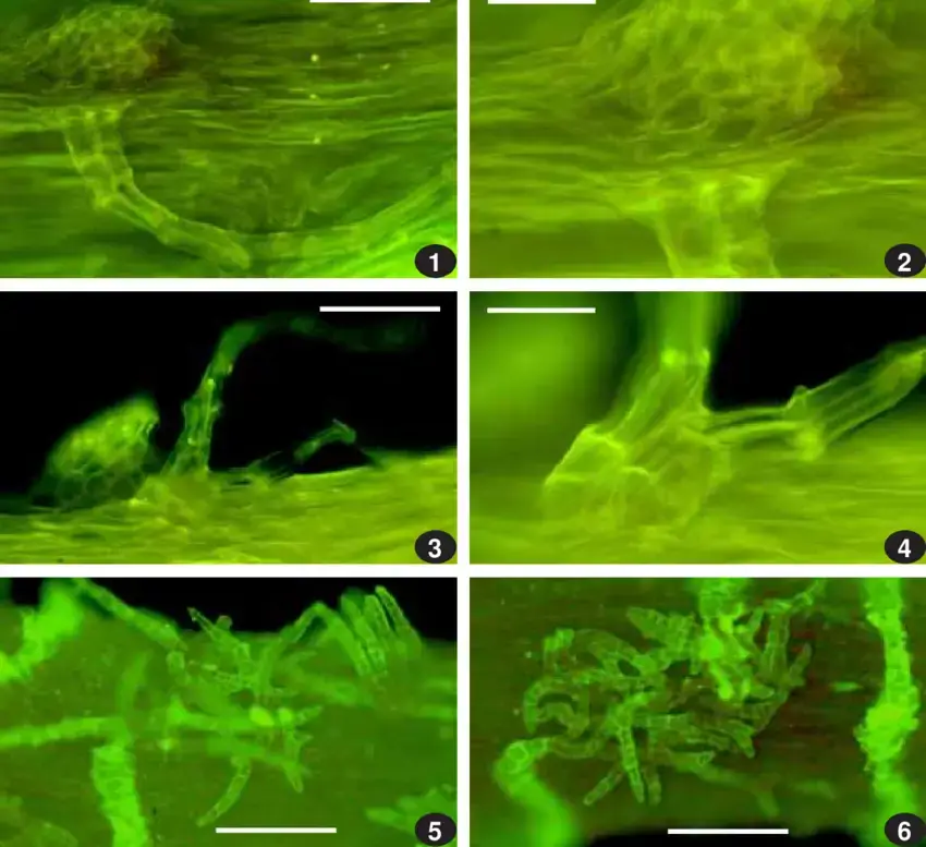 1-4-Sasaokaea-aomoriensis-Musci-Japonici-exsiccati-1314-paraphyllium-beside-branch.png