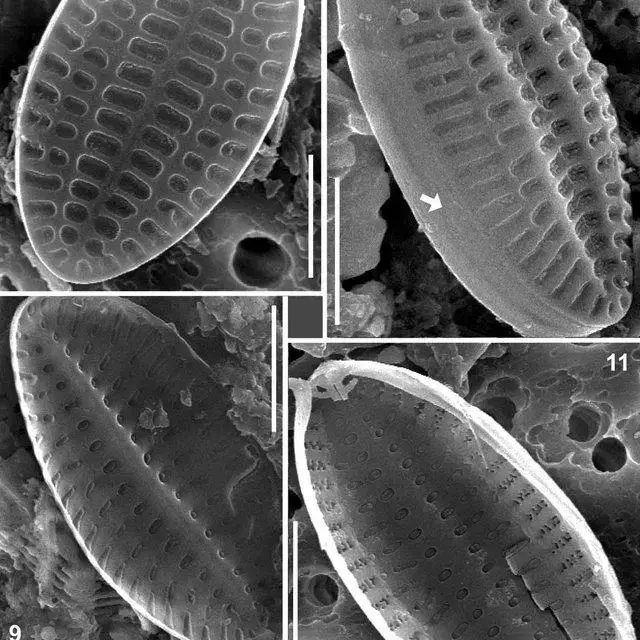 11-Amphicocconeis-mascarenica-SEM-Fig-7-Sternum-valve-SV-external-view-Fig-8_Q640.jpg