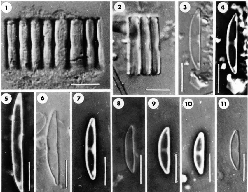 11-Catenula-adhaevens-Scale-10-pm-Fig1-Colony-girdle-view-BM-slide-Giffen-632.png