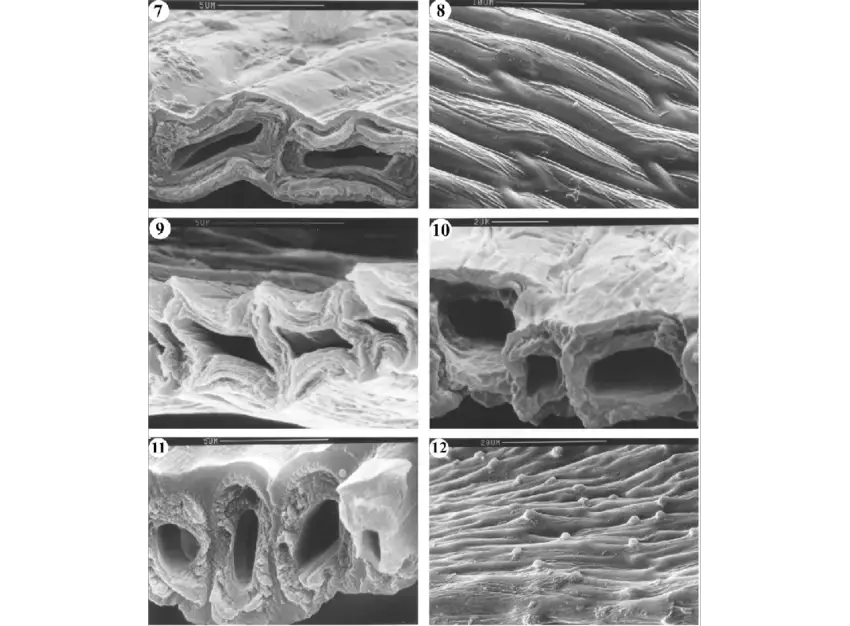 12-7-8-Phyllogonium-v-iscosum-cross-section-of-leaf-7-and-s-urface-of-leaf-8-9.png