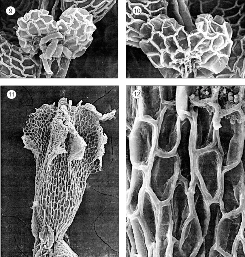 12-Pictolejeunea-piconii-Pocs-9-10-Underleaves-11-Perianth-12-Perianth-cells.png