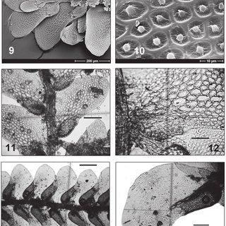 14-9-12-Cololejeunea-floccosa-var-fraseriana-Pocs-var-nov-9-Habit-ventral-view_Q320.jpg