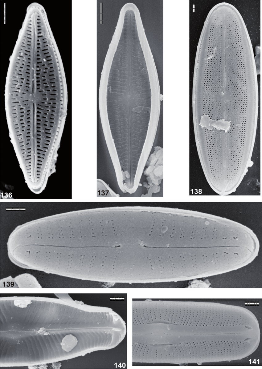 141-SEM-136-137-Brachysira-brebissonii-136-External-view-137-Internal-view-138.png