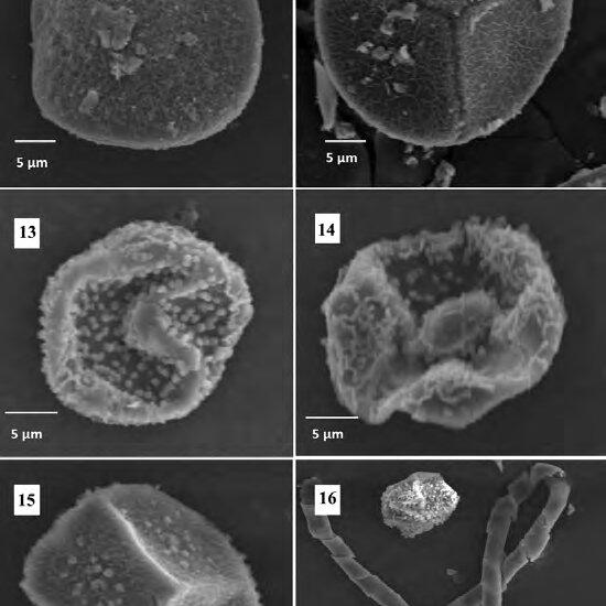 16-Notothylas-javanica-11-Distal-face-of-the-spore-showing-finely-vermiculate_Q640.jpg