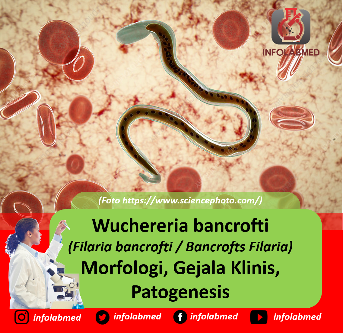 Wuchereria%2Bbancrofti%2B%2528Filaria%2Bbancrofti%2BBancrofts%2BFilaria%2529%2BMorfologi%252C%2BGejala%2BKlinis%252C%2BPatogenesis.png