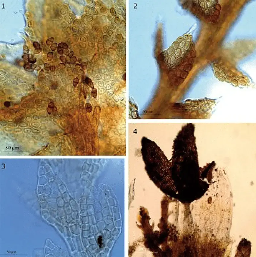 4-Cephaloziella-hampeana-Nees-Schiffn-ex-Loeske-1-Fertile-branch-showing-bracts-and.png