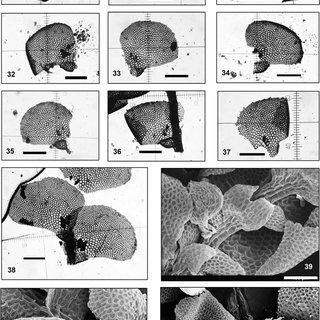 41-Ceratolejeunea-andringitrae-Pocs-sp-nov-29-37-leaves-with-different-arrangements_Q320.jpg