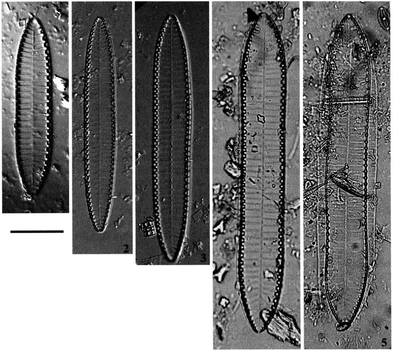 5-Surirellu-engleri-0-Muller-original-material-from-Lake-Malombe-LM-Fig-1.png