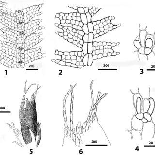 6-Zoopsidella-grahamii-Pocs-sp-nov-1-habit-ventral-view-2-habit-dorsal-view_Q320.jpg