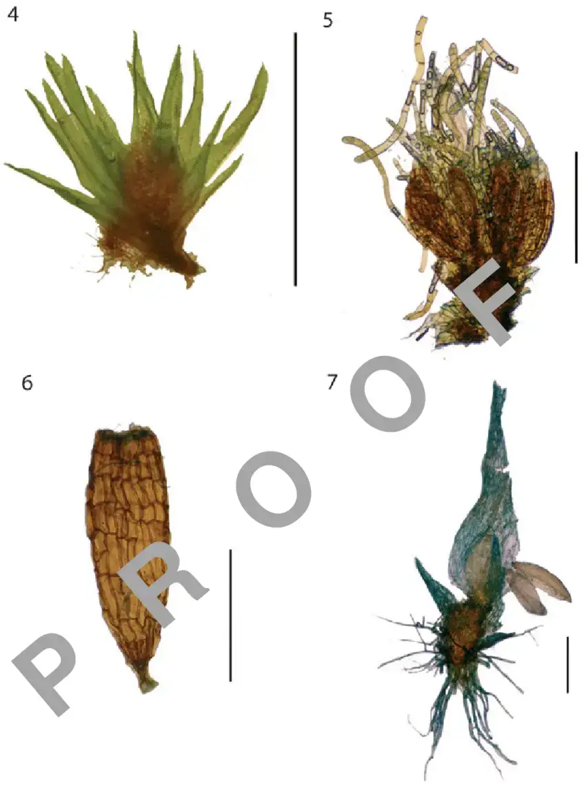 7-4-Dwarf-male-of-Dicranum-undulatum-Schrad-ex-Brid-scale-3-mm-5-Paraphyses-and.png