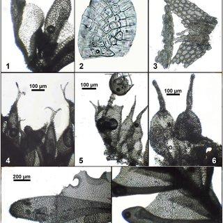 8--3-Colura-australiensis-Ast-from-Pocs-Streimann-9990-C-1-habit-ventral_Q320.jpg