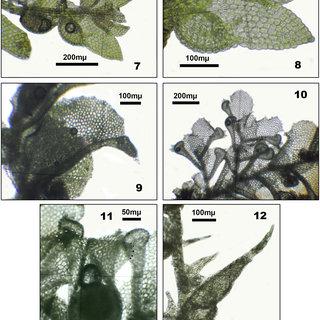 8-Cololejeunea-amphibola-BM-Thiers-7-habit-ventral-view-8-leaf-ventral-view_Q320.jpg