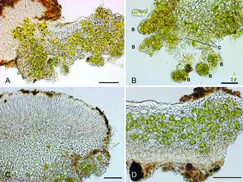 A-Candelariella-blastidiata-section-of-thallus-with-blastidia-B-Candelariella.png