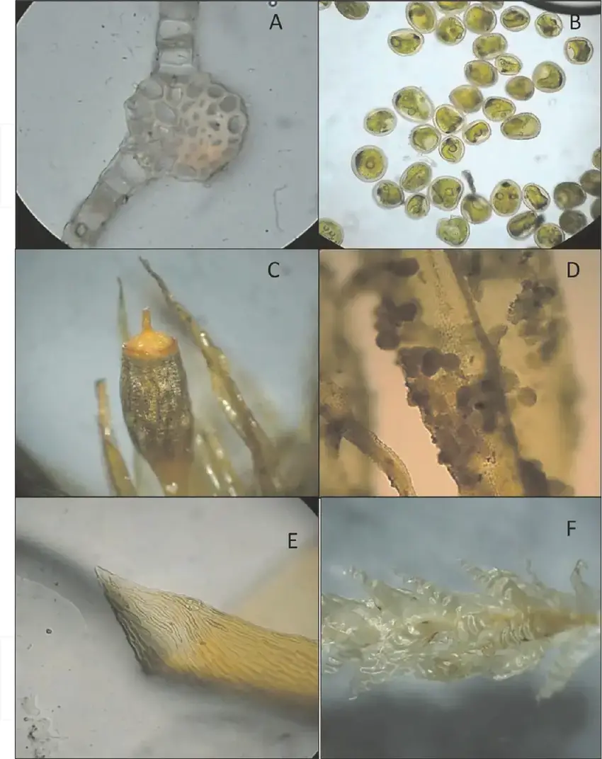 A-Heterogeneous-leave-cross-sectional-Bryum-andicola-hook-40x-B-Gemes-Orthotrichum.png