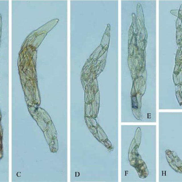 A-J-Propagules-of-Pohlia-proligera-Lindb-ex-Breidl-Lindb-ex-Arn-from-Zhu-Rui-liang_Q640.jpg