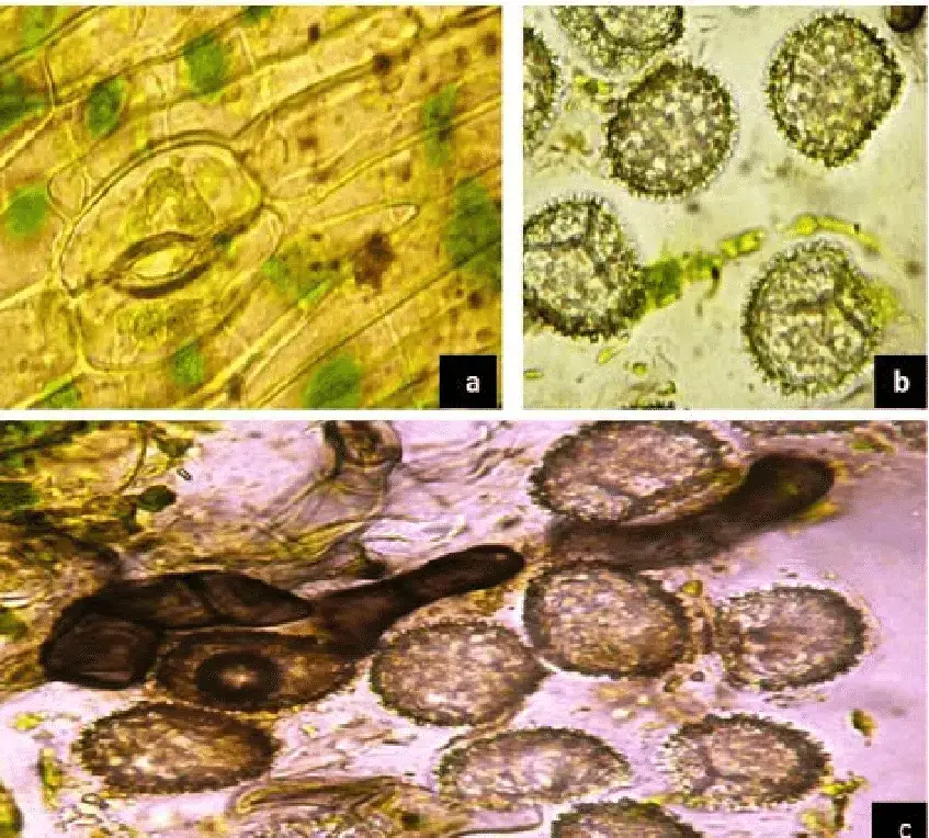 Anthoceros-punctatus-L-a-thin-walled-upper-epidermis-of-capsule-with-stomata-b-Spores.png