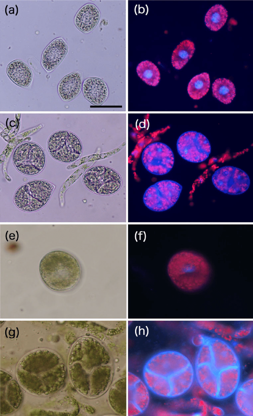 Apolar-sporocyte-of-Sauteria-japonica-and-Athalamia-nana-Cleveaceae-a-Light.png