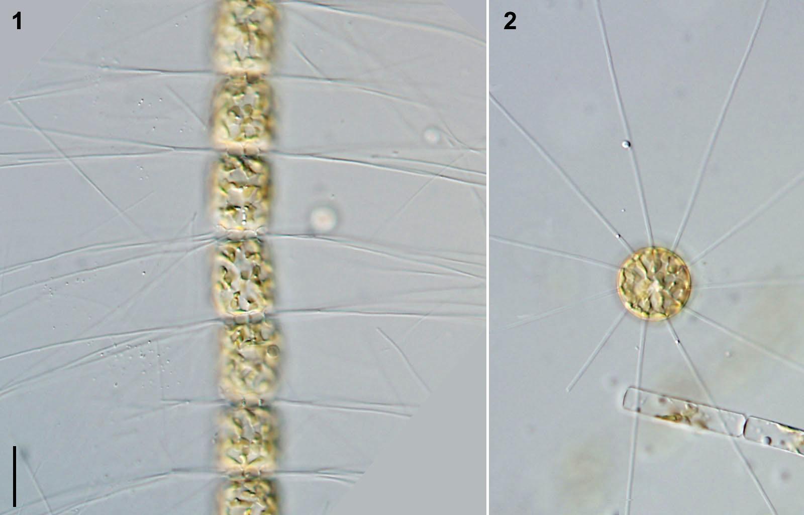 Bacteriastrum_hyalinum.jpg