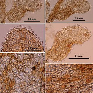 Cololejeunea-nilgiriensis-GAsthana-SCSrivast-1-3-Leaves-showing-spinose-margin-4_Q320.jpg