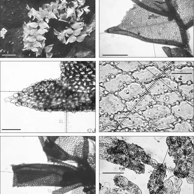 Colura-conica-Sande-Lac-K-I-Goebel-a-habit-dorsal-view-scale-bar-2-mm-b_Q640.jpg