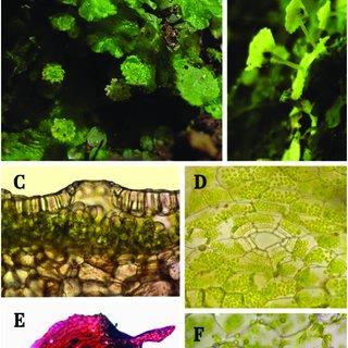 Cryptomitrium-tenerum-Hook-Underw-A-Vista-macroscopica-del-talo-aplanado-B_Q320.jpg