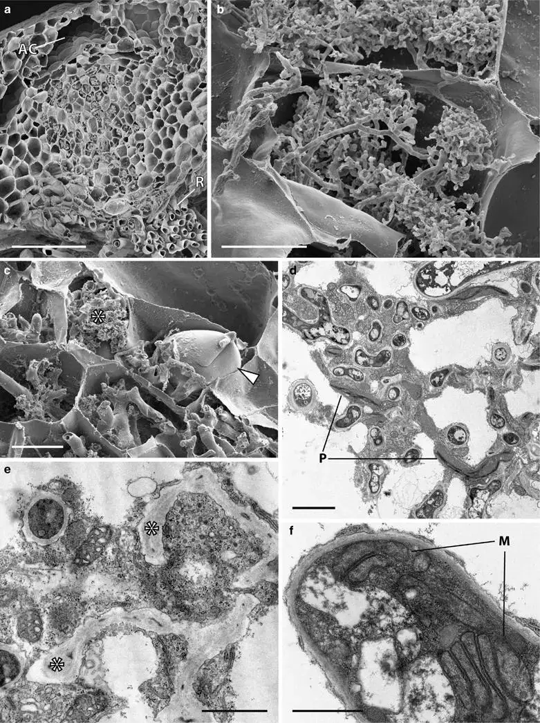 Cytology-of-Neohodgsonia-mirabilis-grown-at-440-and-1500-ppm-aCO2-Scanning-a-c.png