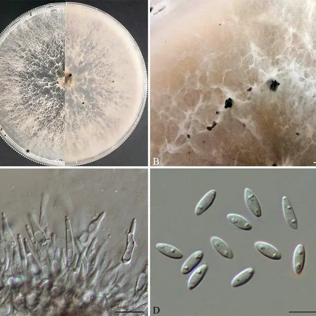 Diaporthe-hunanensis-HNZZ023-A-Culture-on-PDA-B-conidiomata-C-conidiogenous-cells-D_Q640.jpg