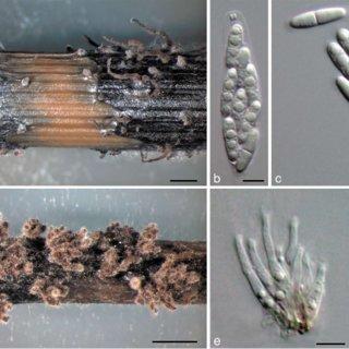 Diaporthe-novem-a-Perithecia-on-F-vulgare-stem-in-culture-CBS-H-20463-b-ascus-with_Q320.jpg