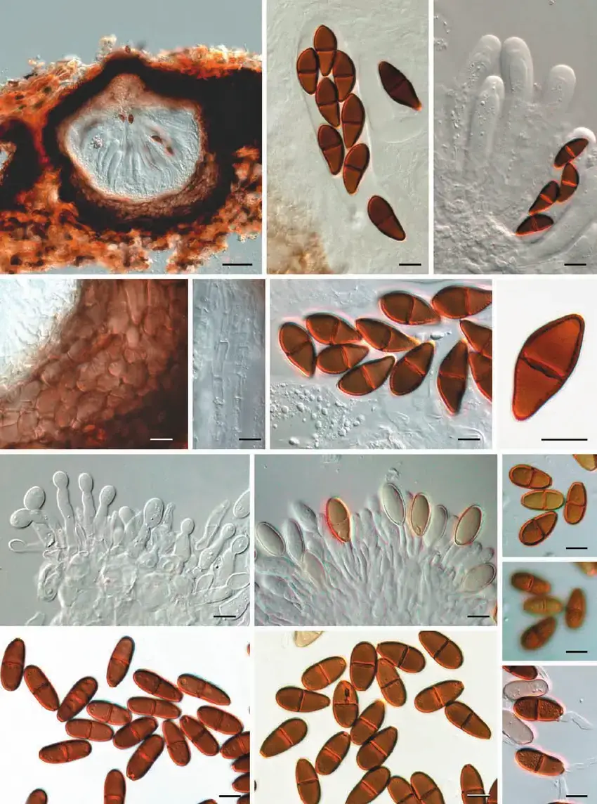 Dothiorella-iberica-a-g-LISE-94944-h-n-CBS-115041-a-Vertical-section-through-an.png