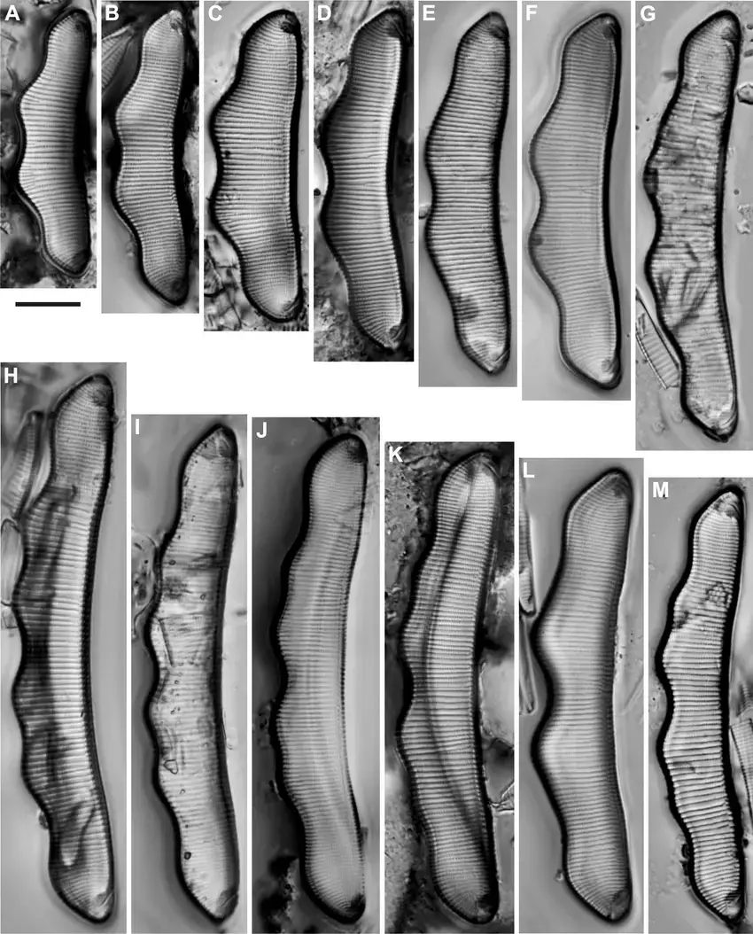 Eunotia-zygodon-LM-Size-diminution-series-from-a-single-population-Note-especially-G.png