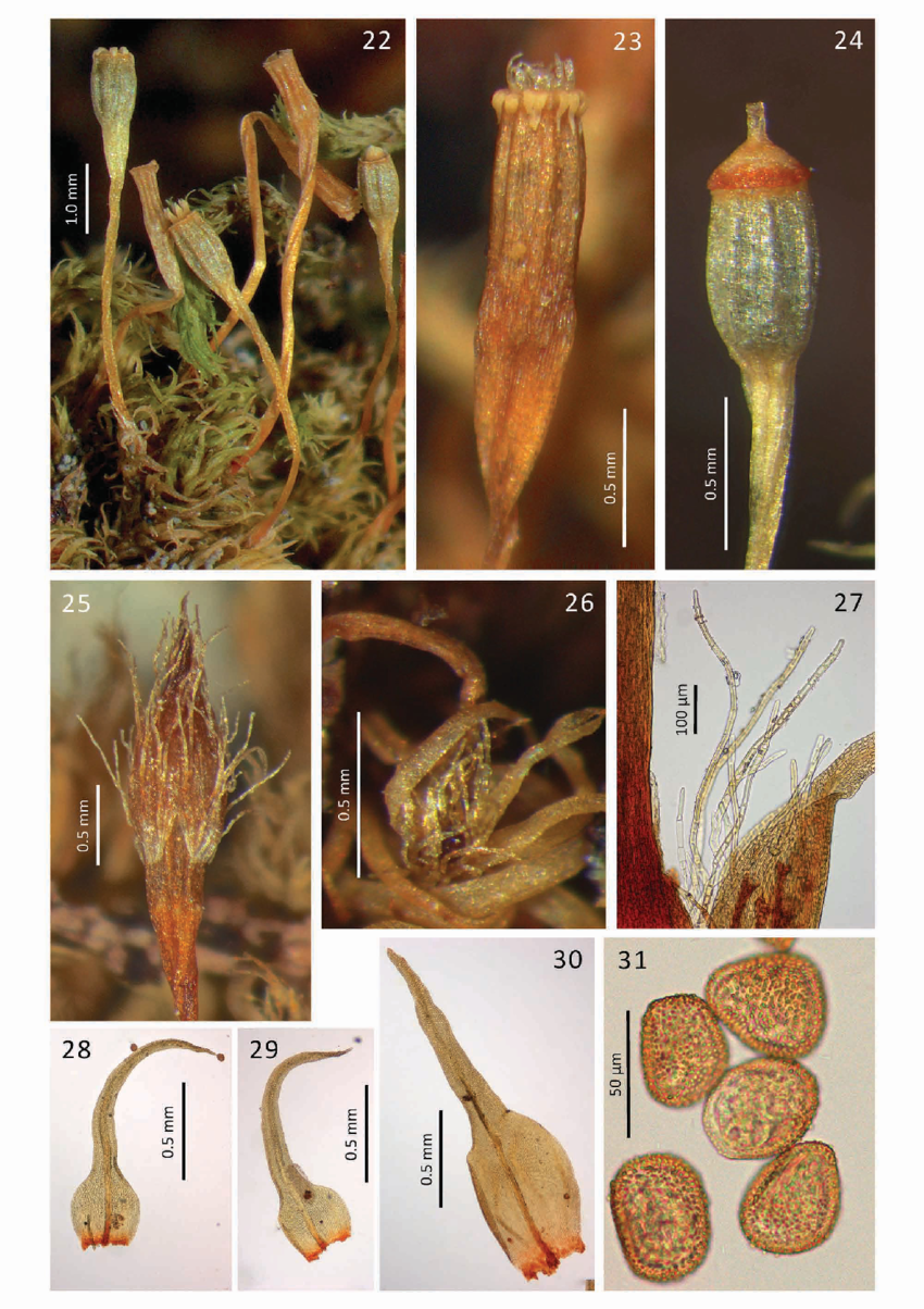 FIGURES-22-31-Ulota-magellanica-22-Habit-23-Mature-capsule-with-the-endostome-erect.png