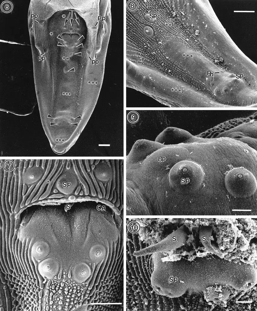 FIGURES-6-10-Posterior-end-of-Turgida-turgida-male-SEM-micrographs-6-Young-male.png