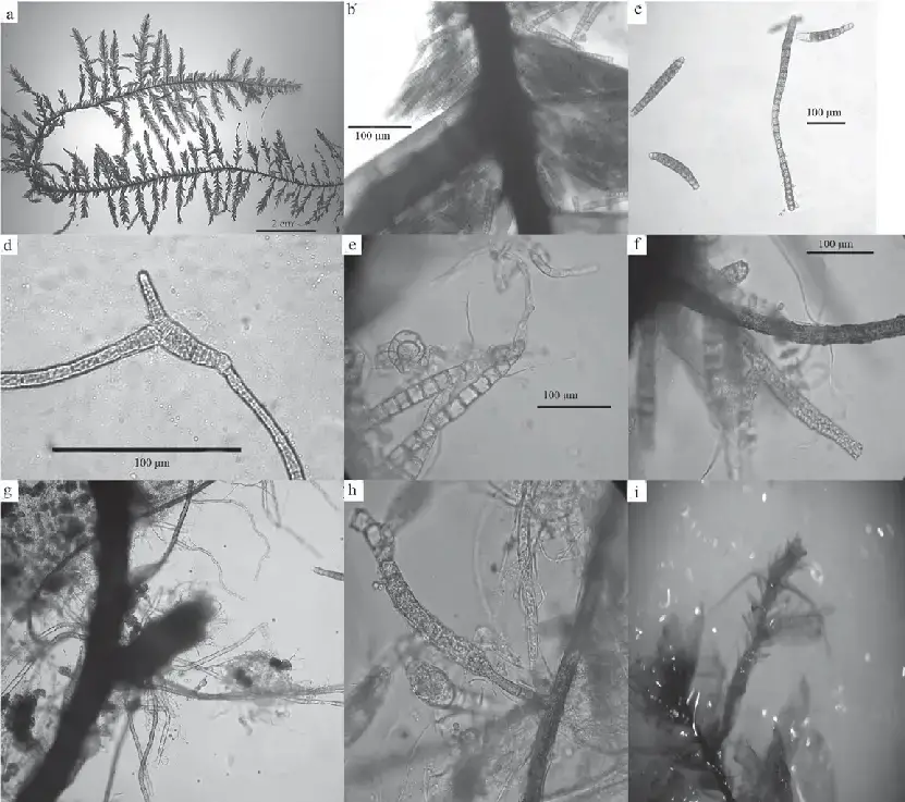 Figura-5-Calyptothecium-duplicatulum-a-Aspecto-de-la-planta-b-propagulos-c-d.png