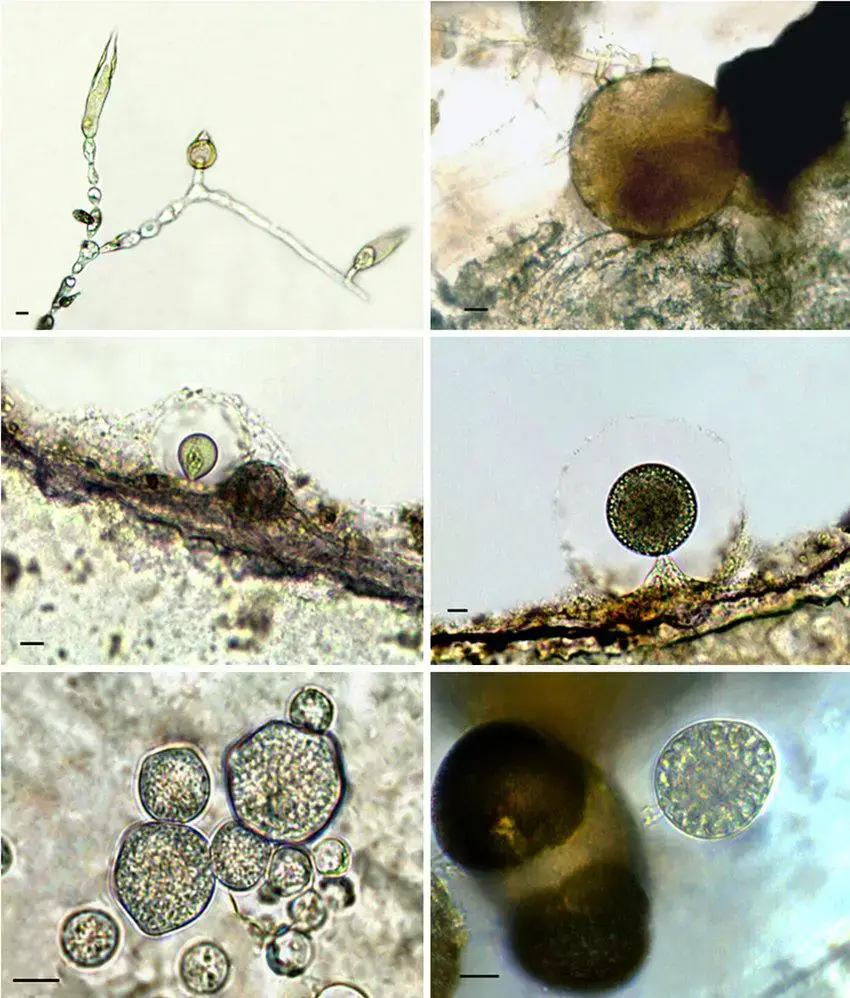 Figura-8-Fungos-zoosporicos-da-Reserva-Biologica-de-Mogi-Guacu-Sao-Paulo-Brasil-a.jpg