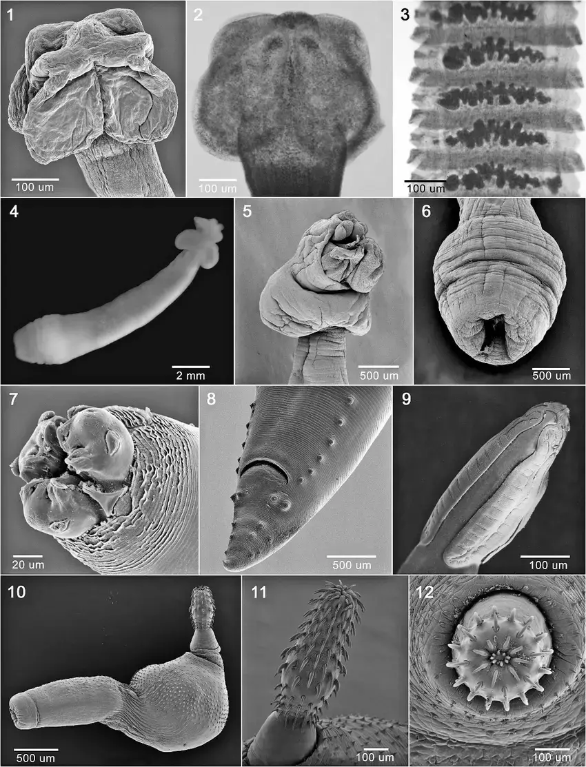 Figures-1-12-Helminths-of-Spheniscus-magellanicus-from-Argentina-1-3-Tetrabothrius.png