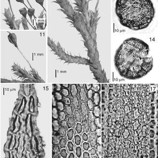 Figures-10-17-Gametophytic-and-sporophytic-features-of-Braunia-squarrulosa-10_Q320.jpg