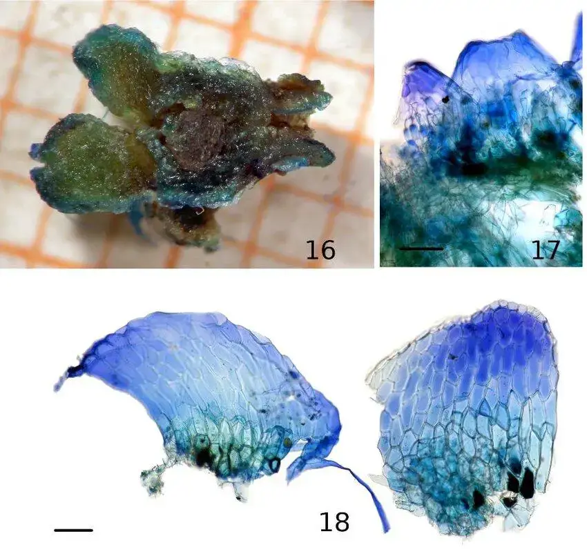 Figures-16-18-Exormotheca-pustulosa-Mitten-16-Close-view-of-a-re-hydrated-thallus.jpg