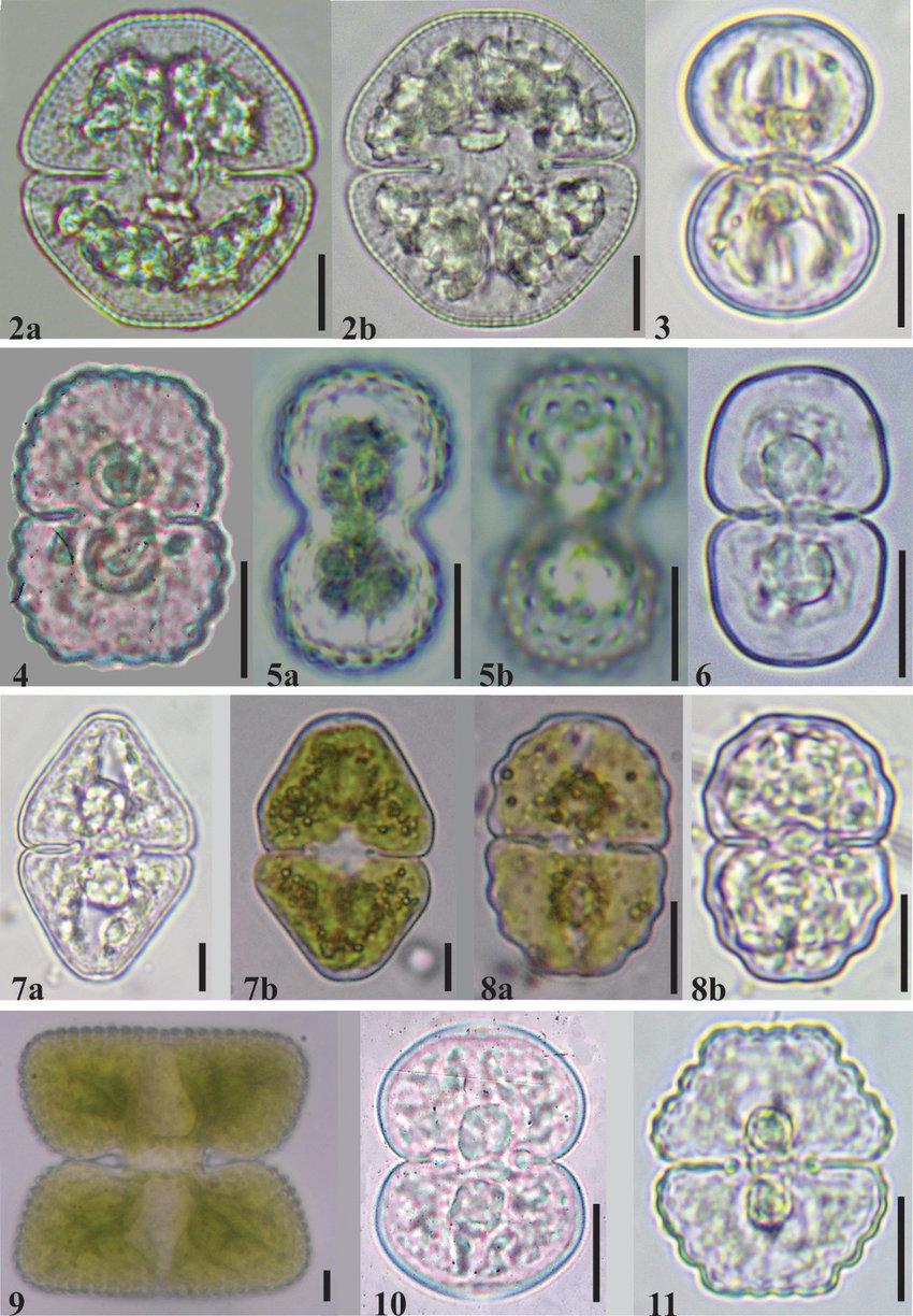 Figures-2-11-Cosmarium-Corda-ex-Ralfs-in-the-Upper-Parana-River-Floodplain-2a-b.jpg