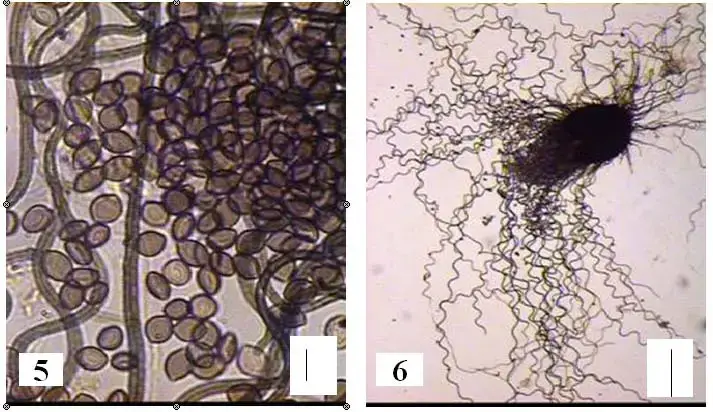 Figures-5-and-6-Chaetomium-convolutum-5-ascospores-6-ascomata-Bar-510m-Bar-6.png