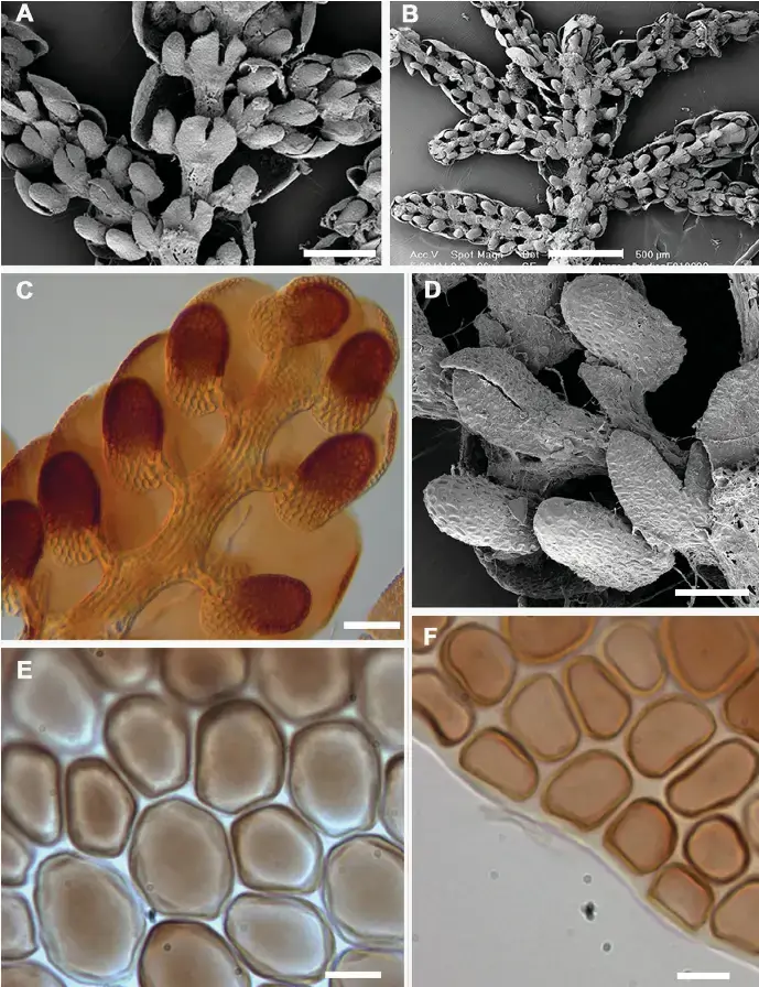 Frullania-knightbridgei-A-B-Main-stem-ventral-view-A-Main-stem-and-lateral-branches.png