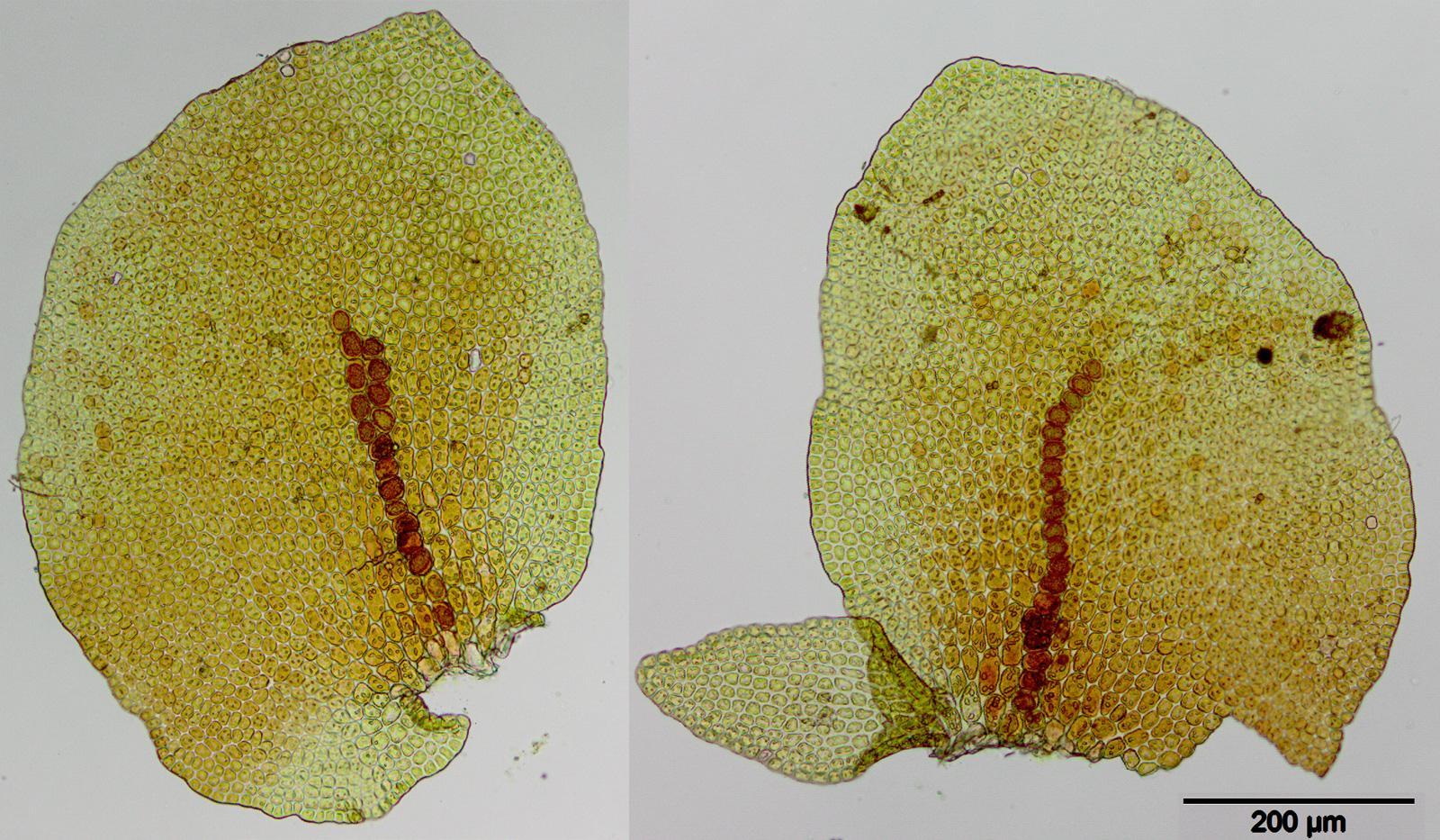 Frullania_asagrayana_BS17.jpg