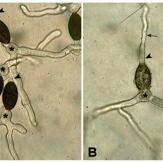 Germination-of-WT-and-Dpah5-ascospores-Ascospores-were-incubated-for-6-h-at-27C-on_Q320.jpg