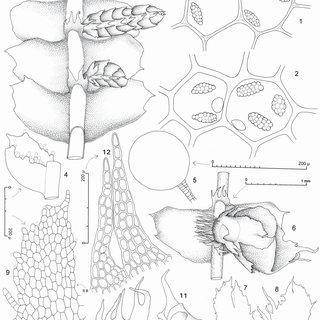 Heteroscyphus-knightii-Steph-Grolle-1-2-Median-leaf-cells-with-oil-bodies-above-X_Q320.jpg