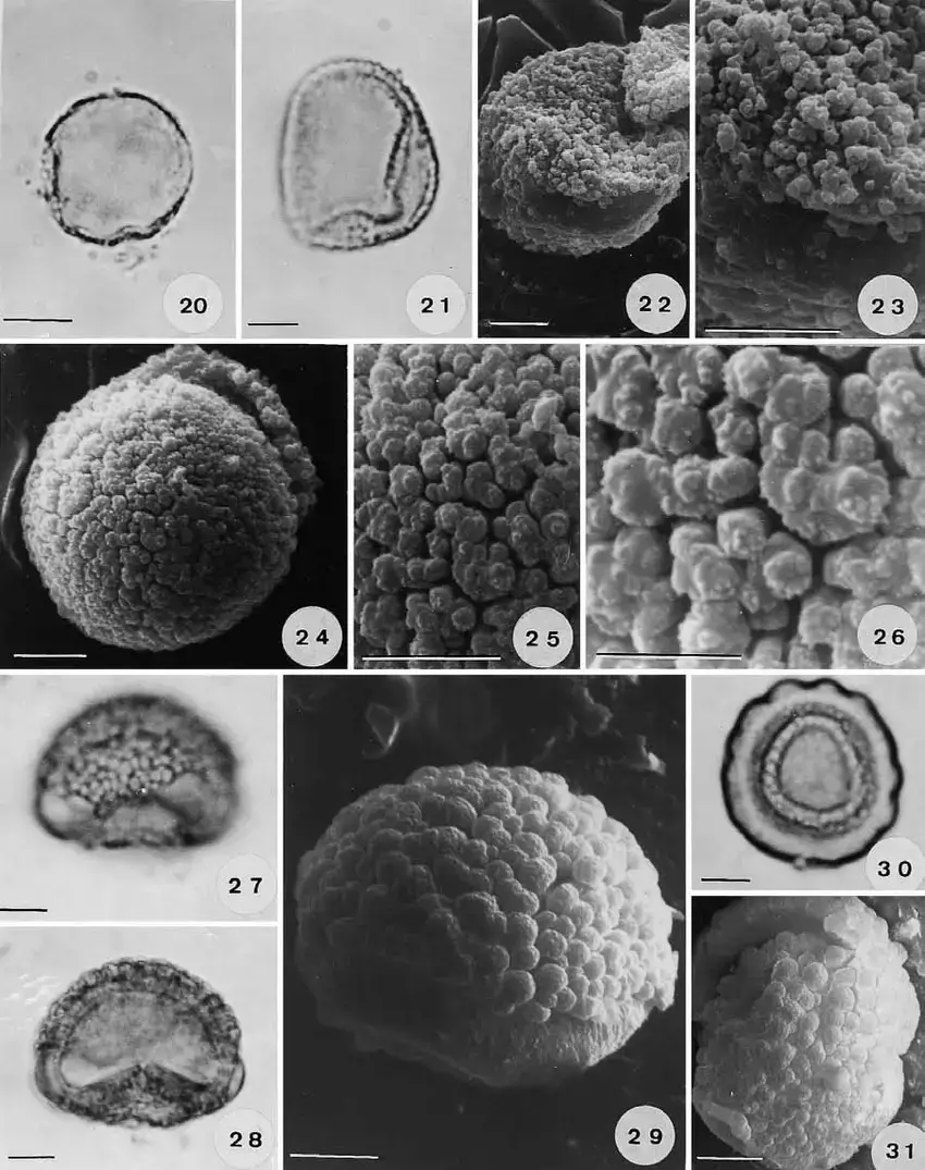 Holomitrium-antennatum-distal-view-surface-Figs-21-23-Holomitrium-olfersianum-21.png