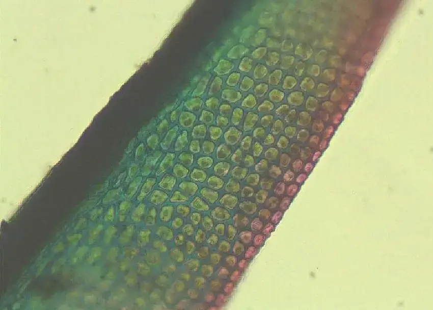 Hymenostylium-aurantiacum-distal-leaf-portion-showing-blue-green-collenchymatous-cells.png