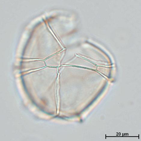 Impagidinium-patulum-lateral-view-Kopie.400.jpg