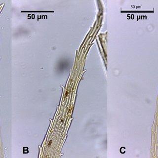 Leaf-apex-differences-between-Sematophyllum-dregei-A-and-B-and-S-gueinzii-C-A-and-B_Q320.jpg