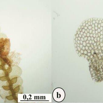 Lejeunea-curviloba-A-Habit-B-Lateral-leaf-C-Leaf-cells-D-Underleaf-Khairani-128_Q640.jpg