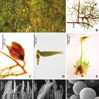 Light-LM-and-scanning-electron-micrographs-SEM-of-Ephemeropsis-tjibodensis_Q320.jpg