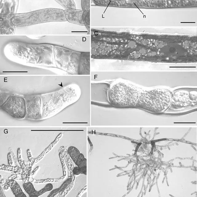 Light-micrographs-of-frozen-and-thawed-protonemal-cells-A-Frozen-cells-mounted-in_Q640.jpg